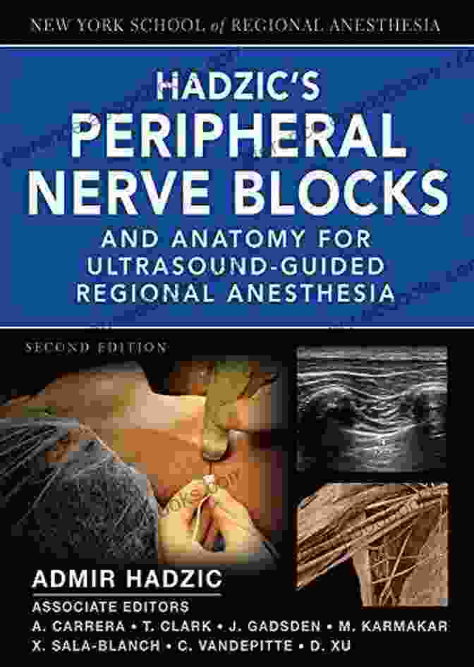 Hadzic Peripheral Nerve Blocks And Anatomy For Ultrasound Guided Regional Anesthesia Hadzic S Peripheral Nerve Blocks And Anatomy For Ultrasound Guided Regional Anesthesia (New York School Of Regional Anesthesia)