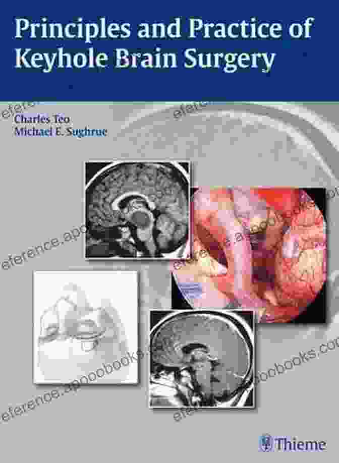 Principles And Practice Of Keyhole Brain Surgery Book Cover Principles And Practice Of Keyhole Brain Surgery