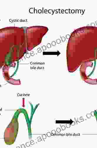 Biliary Tract Surgery An Issue Of Surgical Clinics (The Clinics: Surgery 94)