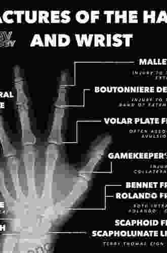 Management Of Complications In Common Hand And Wrist Procedures: FESSH Instructional Course 2024