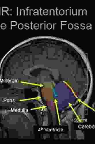 Posterior Fossa Tumors in Children